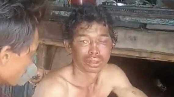 Vụ 2 ngư dân bị tra tấn: Cảnh báo vấn nạn bạo lực trong hoạt động nghề cá