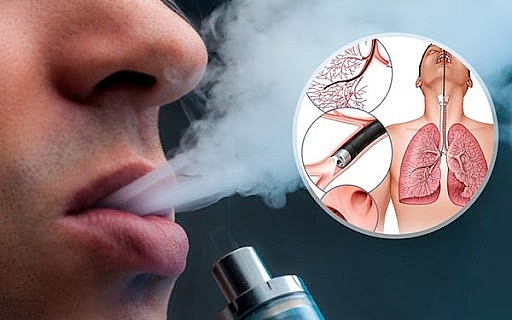Bé 5 tuổi suýt mất mạng vì ngộ độc ma tuý tổng hợp 'nguỵ trang' trong thuốc lá điện tử