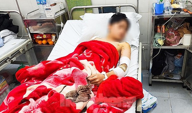 Bác sĩ thông tin về sức khỏe nam sinh bị 2 chó dữ tấn công khi đang đi đường