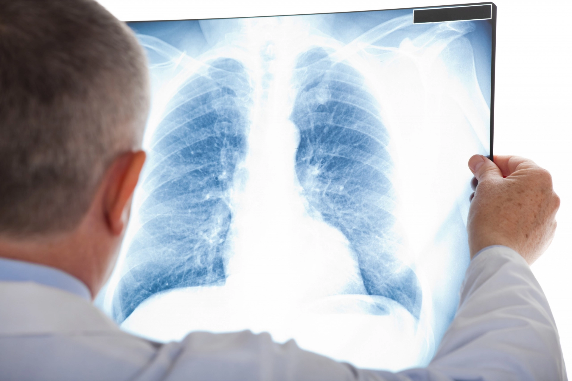 Đừng coi thường bệnh bụi phổi nghề nghiệp